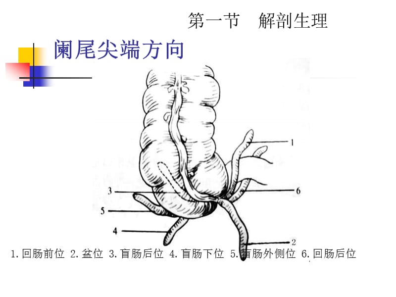 外科学教学课件（暨南大学）本科生大课-急性阑尾炎.ppt_第3页