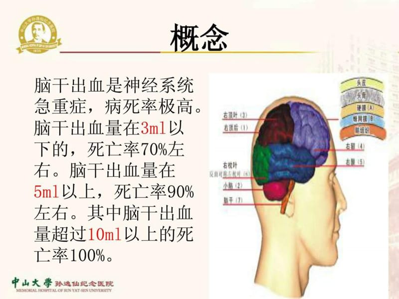 脑干出血的护理-.ppt_第3页