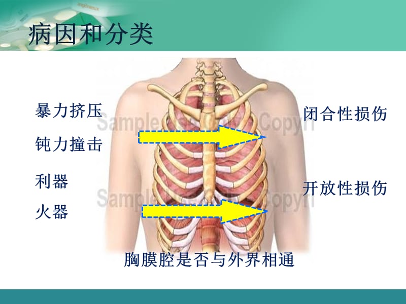 胸部疾病病人的护理.ppt_第3页