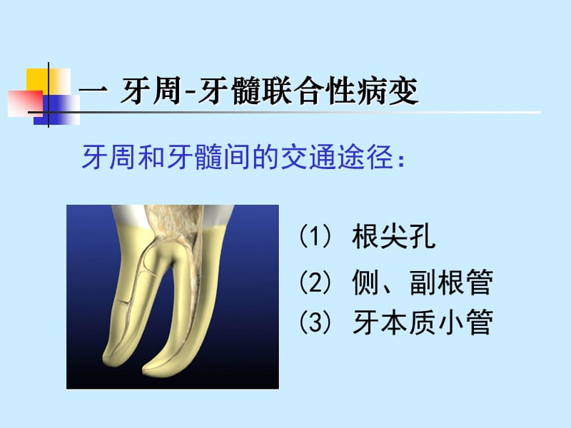 牙周炎治疗.ppt_第2页