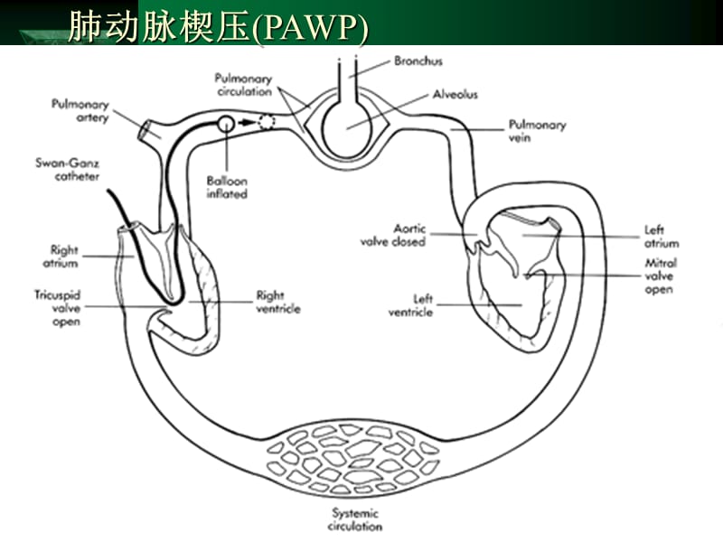 漂浮导管的临床应用.ppt_第2页