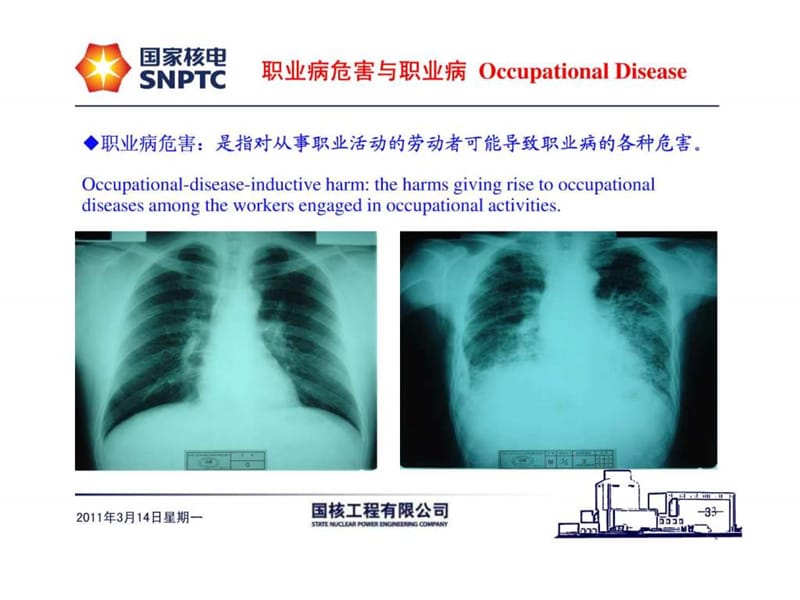 职业病防治全员培训 中英文.ppt.ppt_第3页