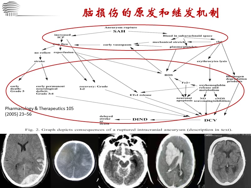 目标化镇静和体温管理与脑保护.ppt_第3页