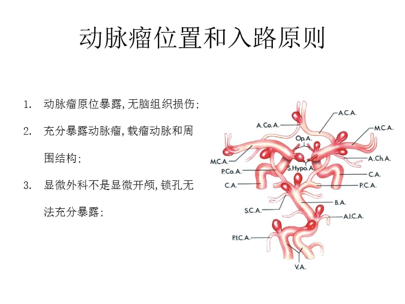 颅内动脉瘤手术入路.ppt_第2页