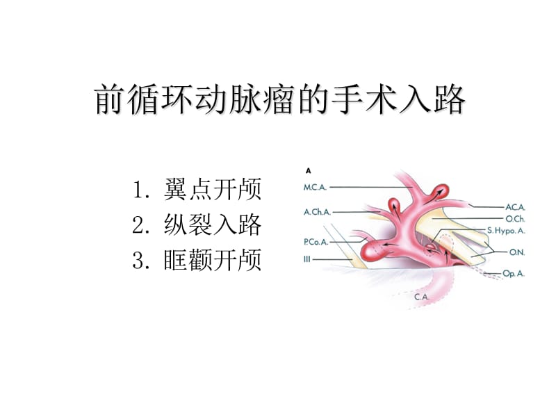 颅内动脉瘤手术入路.ppt_第3页