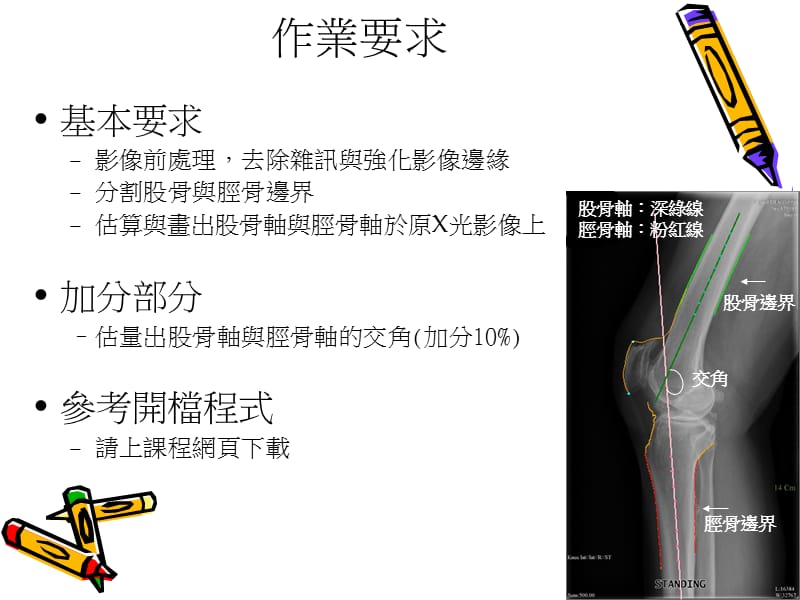 醫療影像分析.ppt_第3页