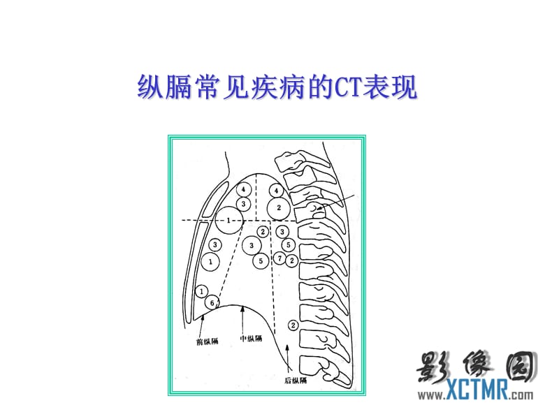 0398纵膈常见疾病的CT表现.ppt_第1页