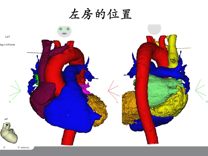 左房标测与消融.ppt_第3页