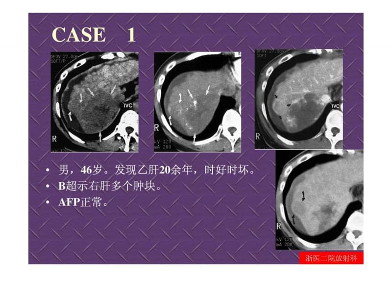 临床思维和技能训练-腹部病变影像鉴别诊断.ppt.ppt_第2页