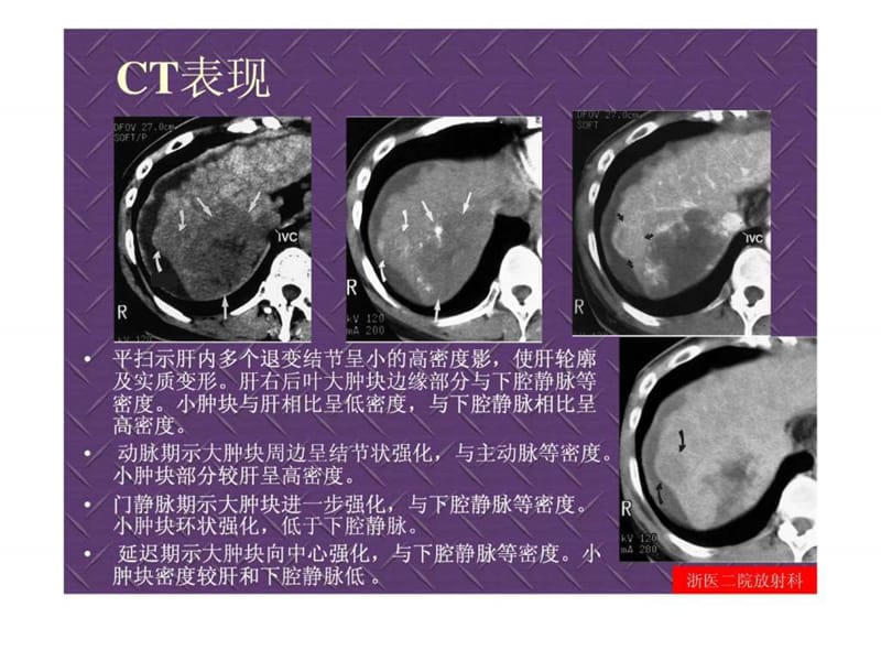 临床思维和技能训练-腹部病变影像鉴别诊断.ppt.ppt_第3页