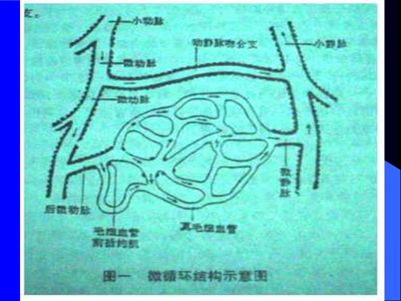 5月份外科休克.ppt_第3页