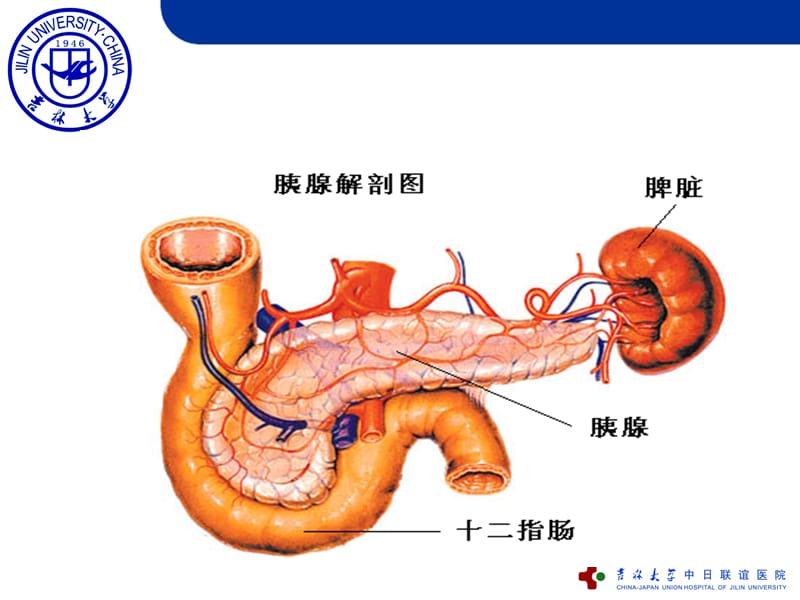 急性重症胰腺炎的护理.ppt_第2页