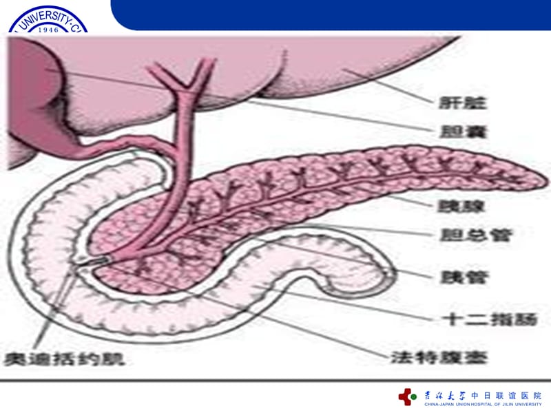 急性重症胰腺炎的护理.ppt_第3页