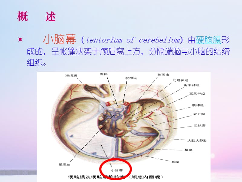 幕下肿瘤的护理.ppt_第3页