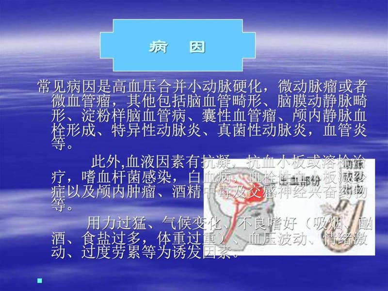 脑出血护理_图文_1509491415.ppt.ppt_第3页