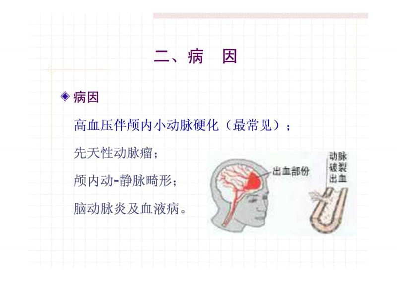 脑出血-蛛网膜下腔出血护理.ppt.ppt_第2页