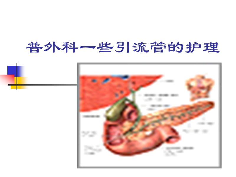 各种引流管的护理.ppt_第2页