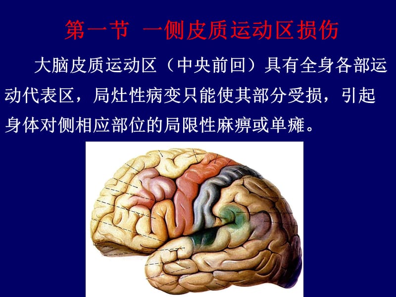 神经内科定位诊断.ppt_第2页