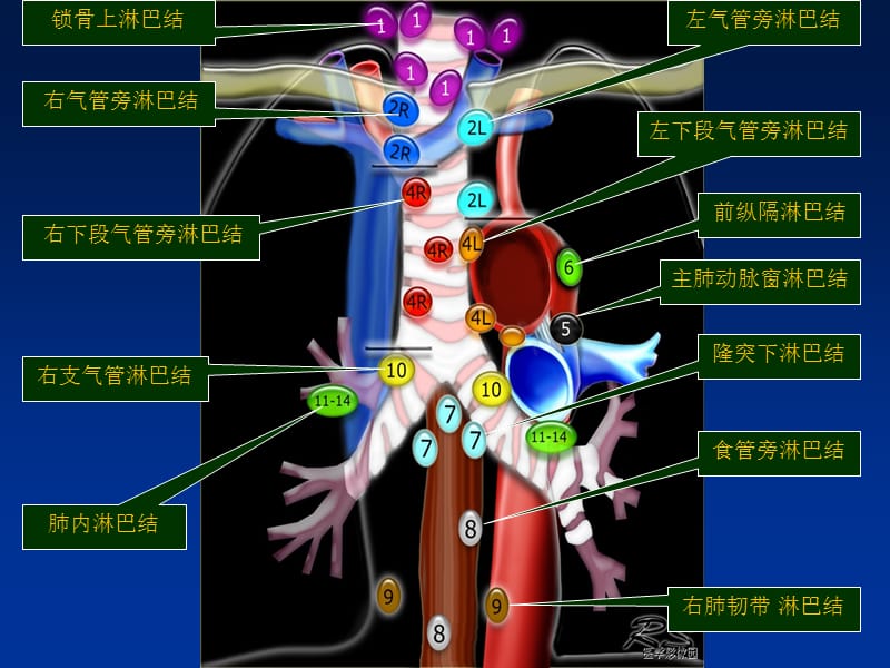 肺癌纵膈肺门淋巴结分区及CT图像.ppt_第3页