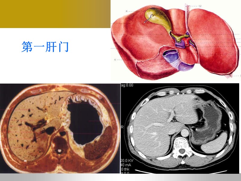 肝脏血管系统疾病影像诊断.ppt_第3页