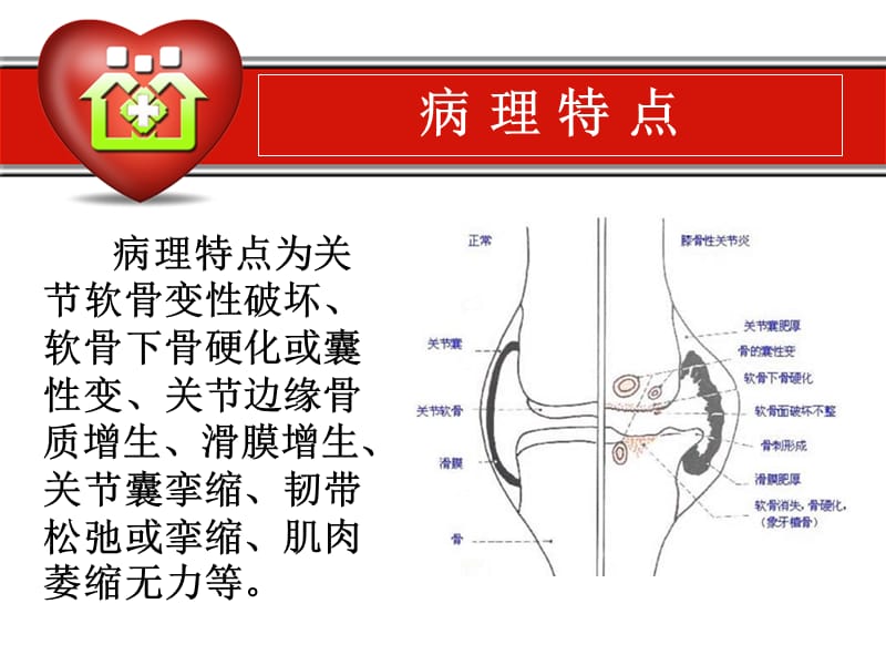 骨性关节炎的康复.ppt_第3页