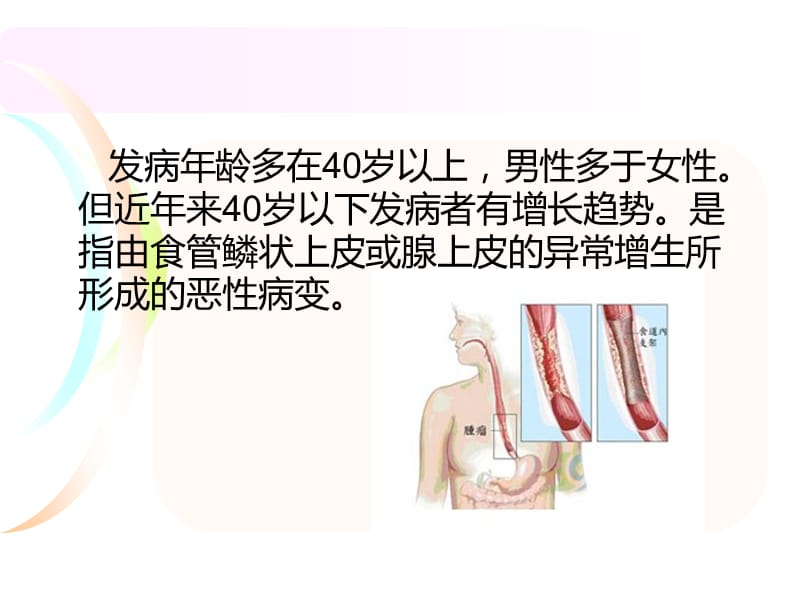 食管癌病人围手术期的护理.ppt_第3页