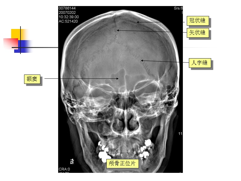 中枢神经系统医学影像.ppt_第2页