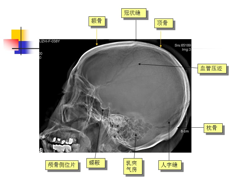 中枢神经系统医学影像.ppt_第3页