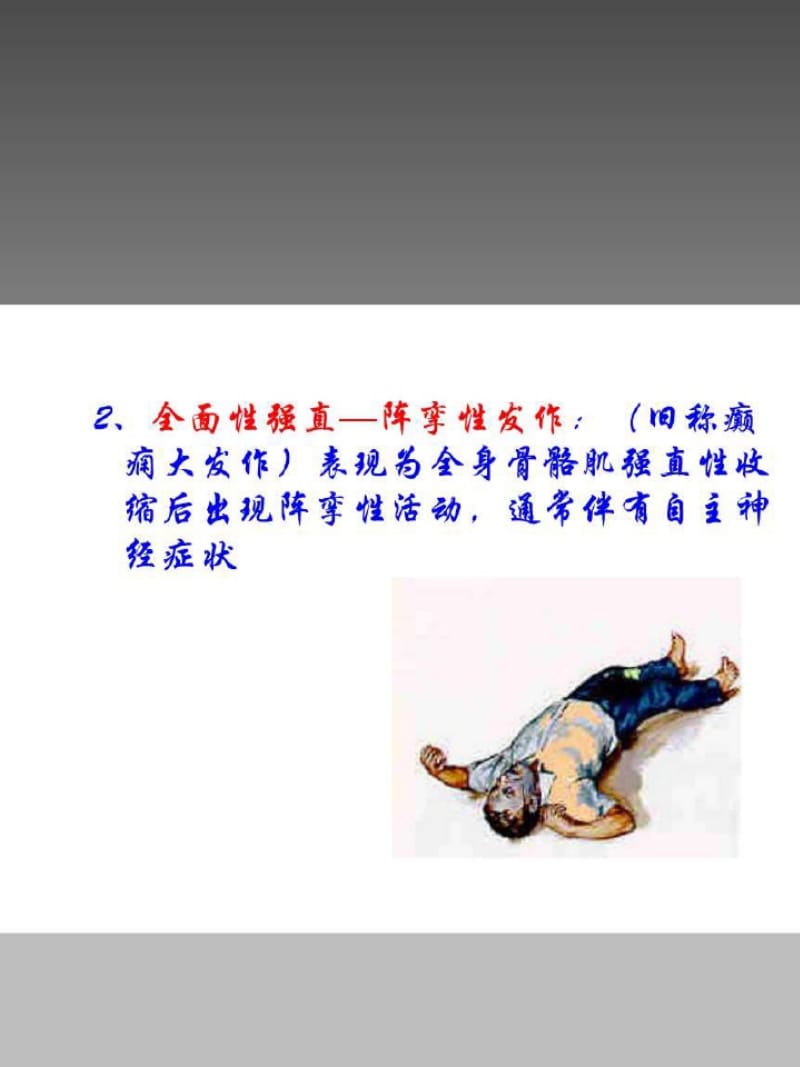 全身强直阵挛性癫痫发作讲解-课件.ppt_第3页