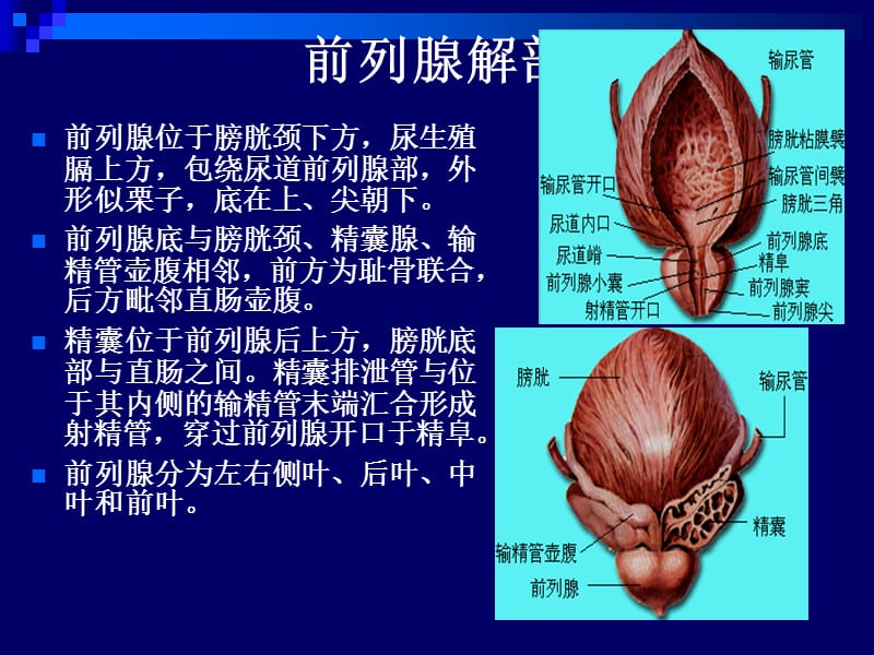 前列腺超声.ppt_第2页