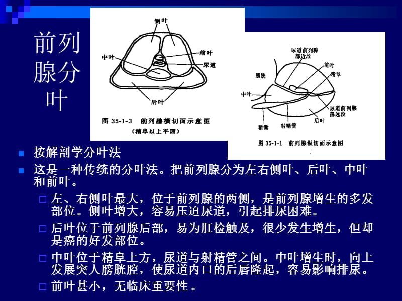 前列腺超声.ppt_第3页