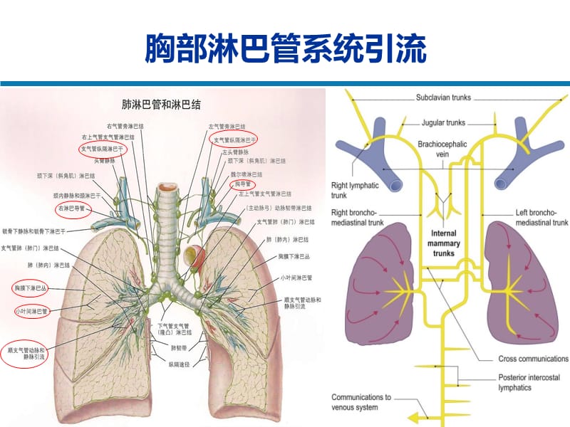 肺淋巴管疾病.ppt_第3页