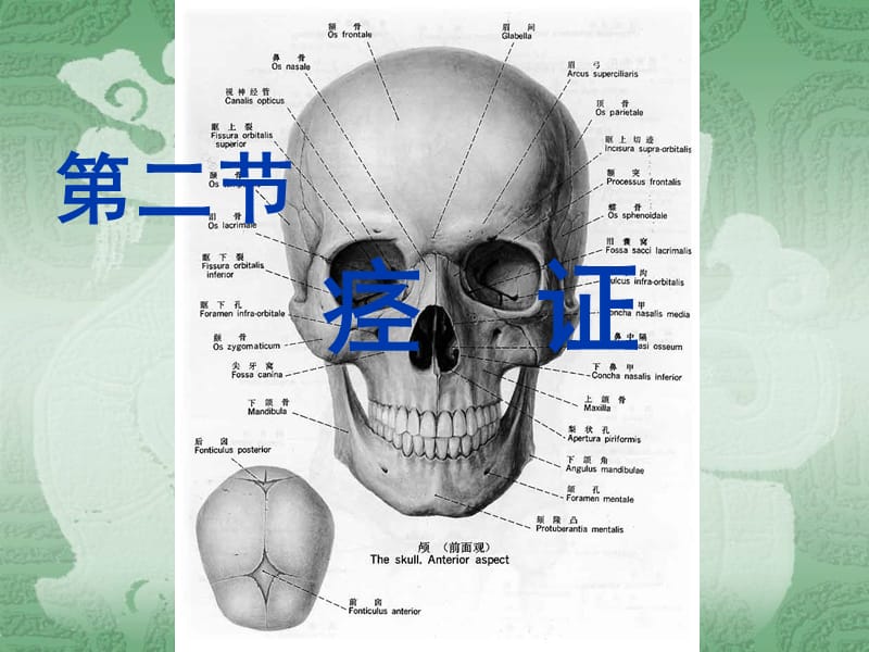 痉证.ppt_第1页