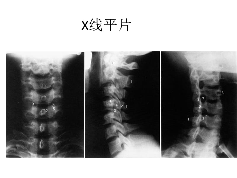 《脊柱解剖》ppt课件.ppt_第2页