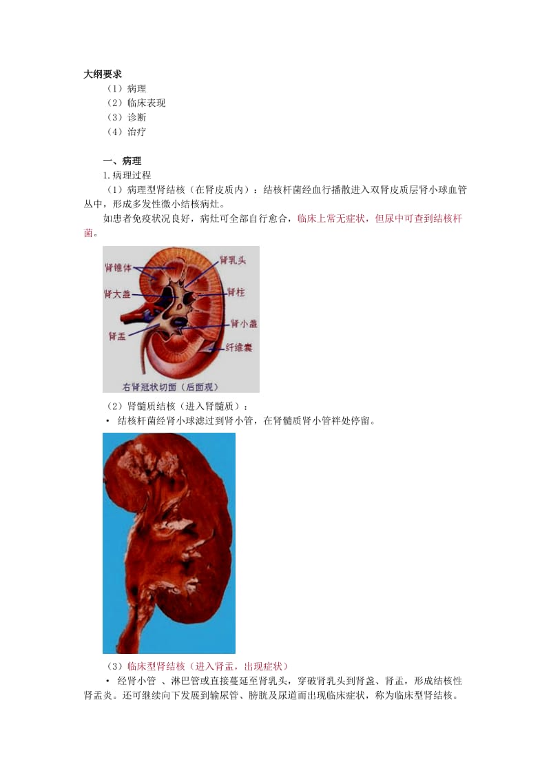 第五章肾结核.doc_第1页