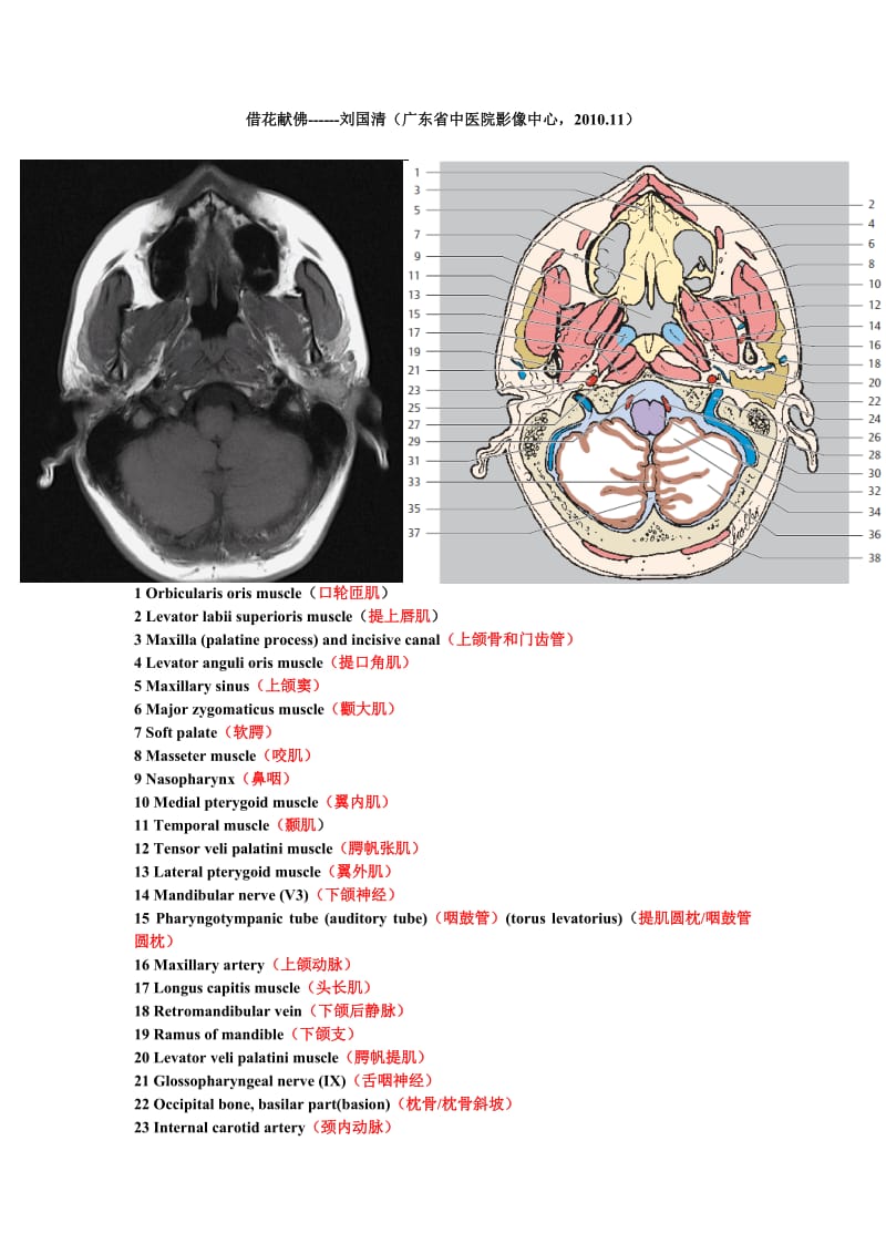 鼻咽部断层解剖图.doc_第1页