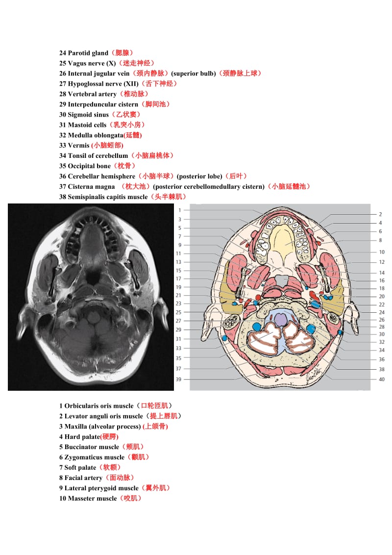 鼻咽部断层解剖图.doc_第2页