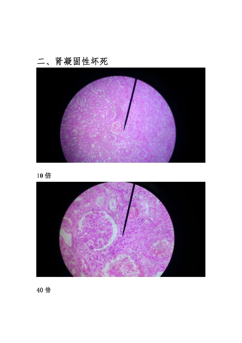 病理切片整理.doc_第3页