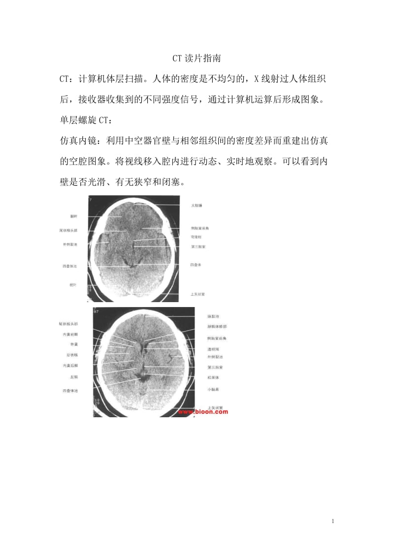 CT读片指南.doc_第1页