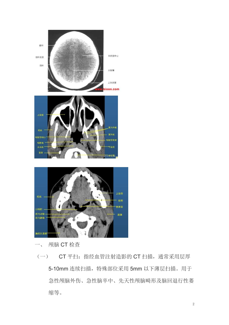 CT读片指南.doc_第2页