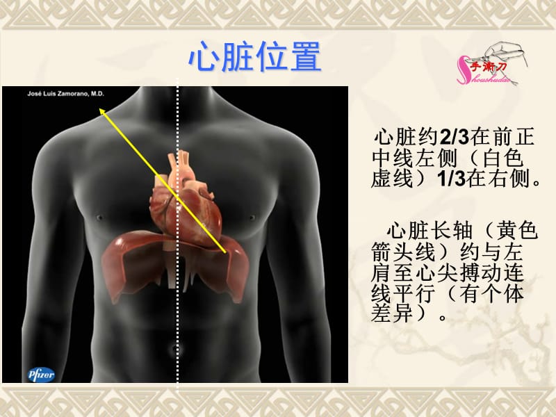 超声心动图常用切面的打法图解.ppt_第2页