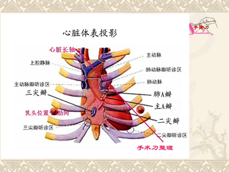 超声心动图常用切面的打法图解.ppt_第3页