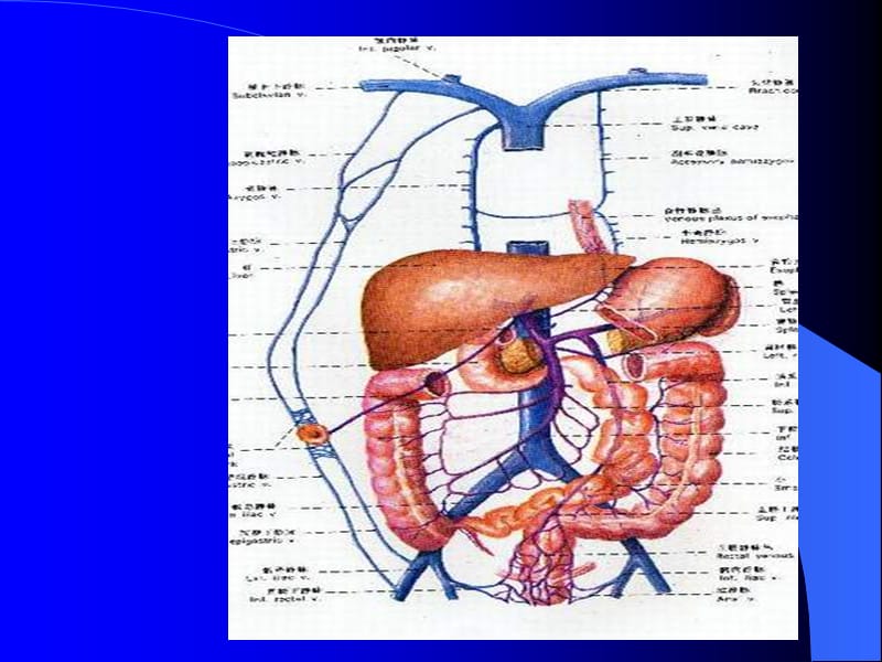 肠梗阻教学小讲座.ppt_第3页