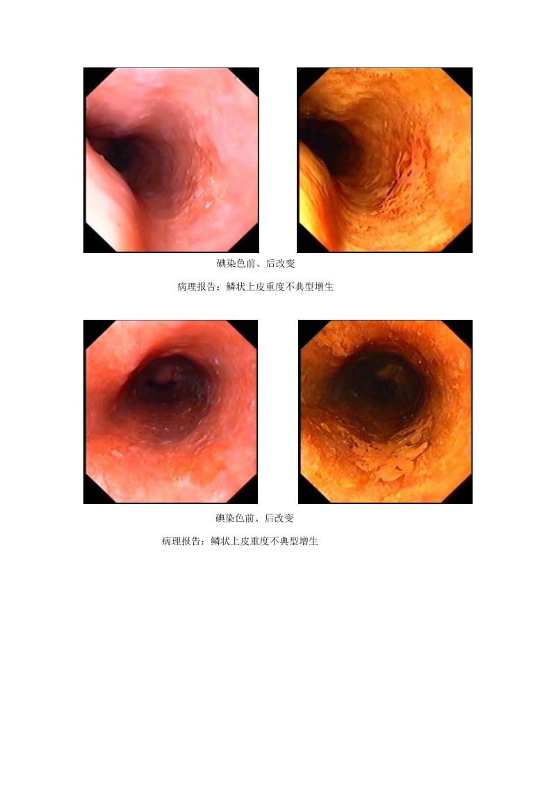 201042食管胃检查的染色内镜技术.doc_第3页