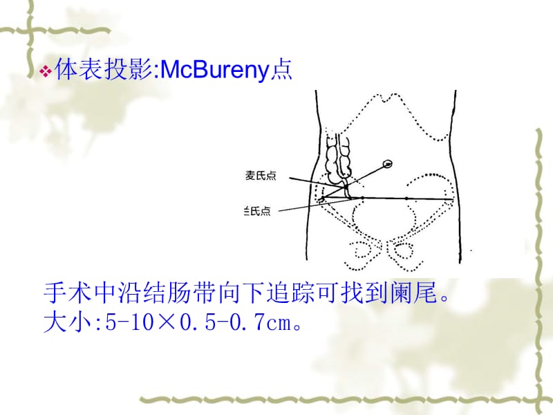 阑尾炎2013概论.ppt_第2页