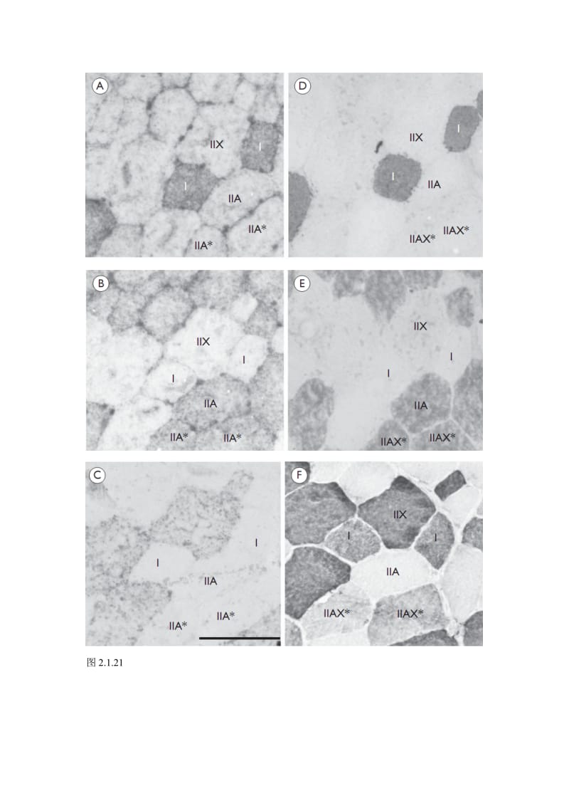 musclerfibertype.doc_第3页
