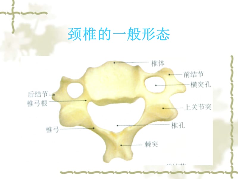 颈椎病的X线征象与临床.ppt_第3页