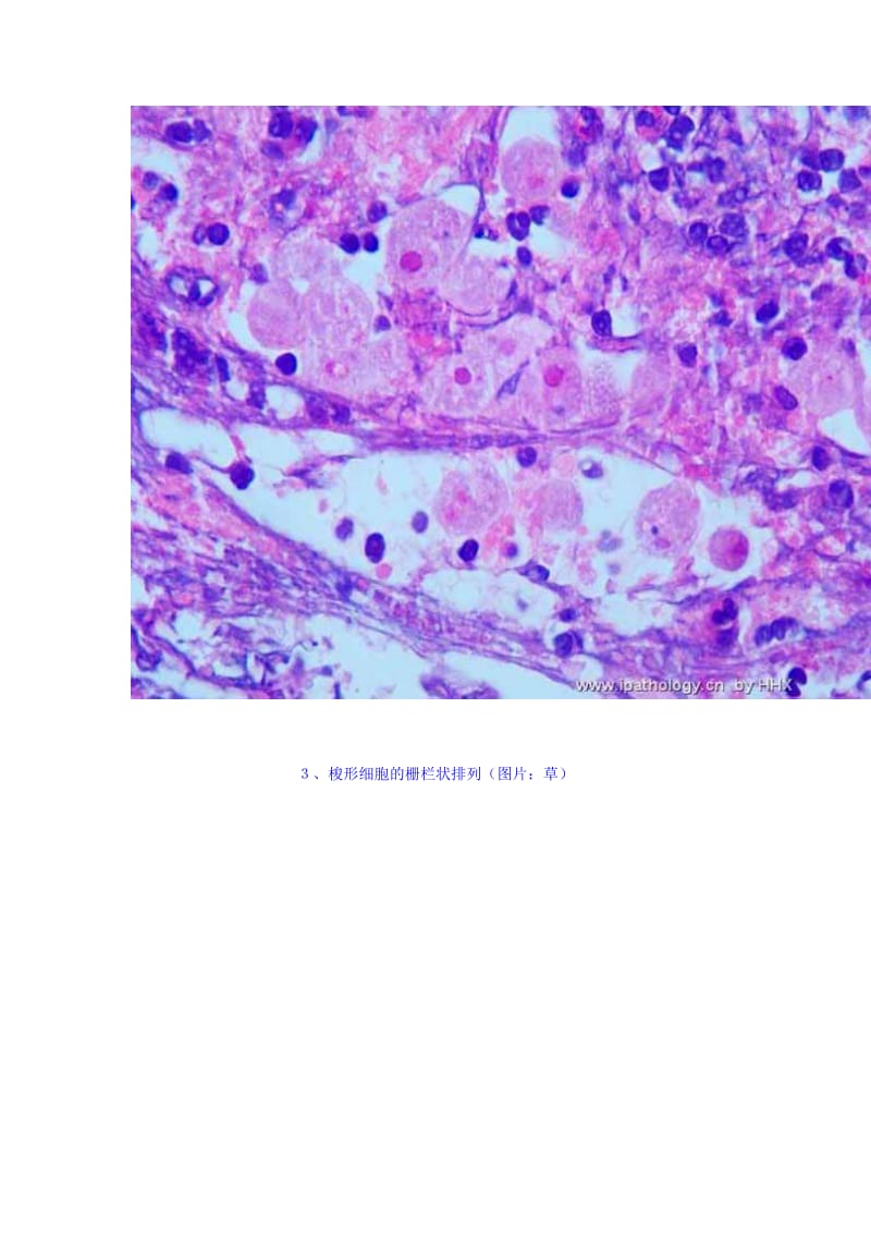 病理基础图片收集专帖.doc_第2页