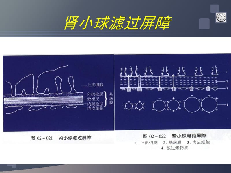 蛋白尿的鉴别诊断.ppt_第3页