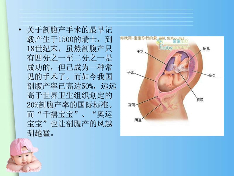 《剖宫产术中配合》PPT课件.ppt_第2页